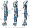The most frequent variations of the veins of the forearm (schematic). 