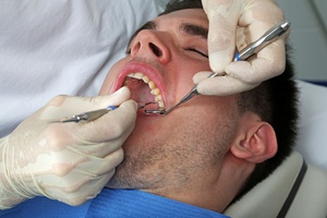 Советы стоматологов лечить ли осложнённый кариес у восьмерки